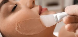 Peeling viso a Roseto degli Abruzzi (Teramo)