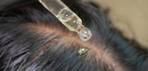 Contagocce che rilascia una goccia di lozione sul cuoio capelluto