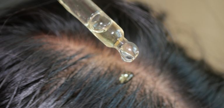 Contagocce che rilascia una goccia di lozione sul cuoio capelluto